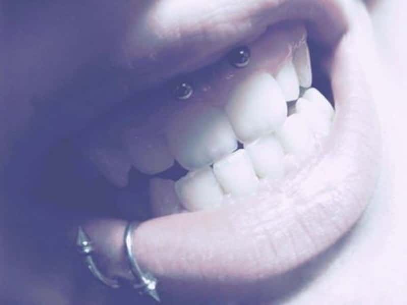 smiley piercing